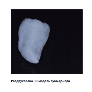 3D-модель-зуба